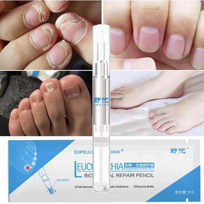 Bio Pen Nail Fungal Treatment Nails Accessories 1PC