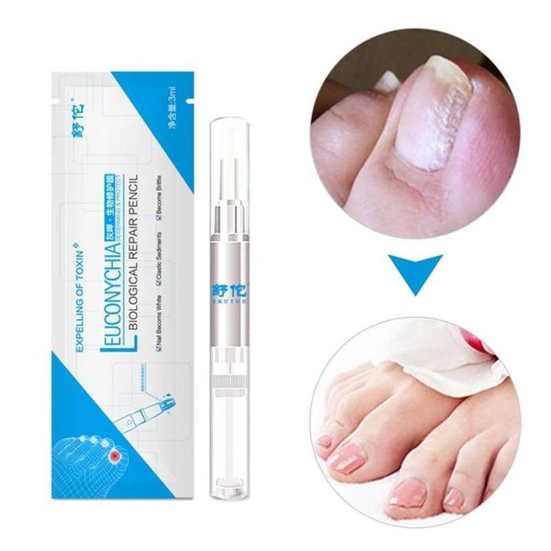 Bio Pen Nail Fungal Treatment Nails Accessories 1PC