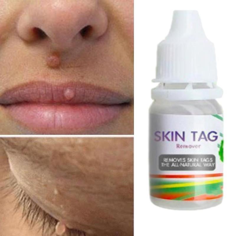 Skin Tag Remover Skin Care 1PC